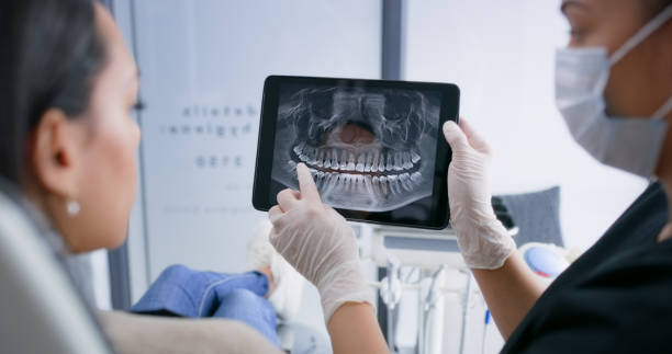 Licensed Tooth Extraction service in Mansfield, OH - Smile Center Dentistry